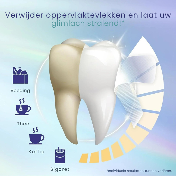Whitening Strips 14-daagse behandeling