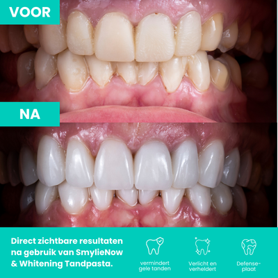 Volwassen tandenborstel + GRATIS tandpasta
